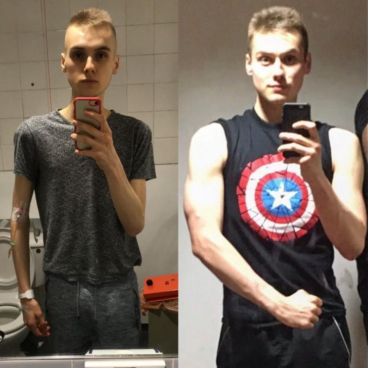 6. Dieser junge Mann hat es endlich geschafft, seine Anorexie zu besiegen und an Gewicht und Muskeln zuzulegen.