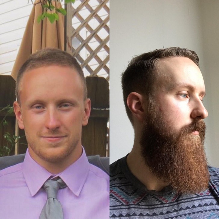 "10 mesi di progresso della barba, rifinendola ogni 3-6 settimane"