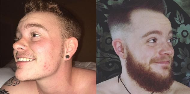 "Progresso della barba, da 6 mesi a 3 anni."