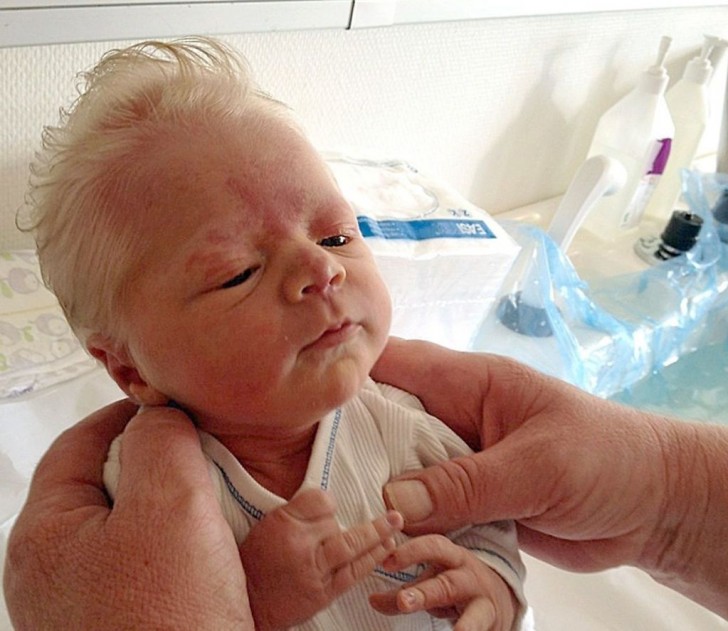 17. Hier ist der Look eines norwegischen Babys bei der Geburt!
