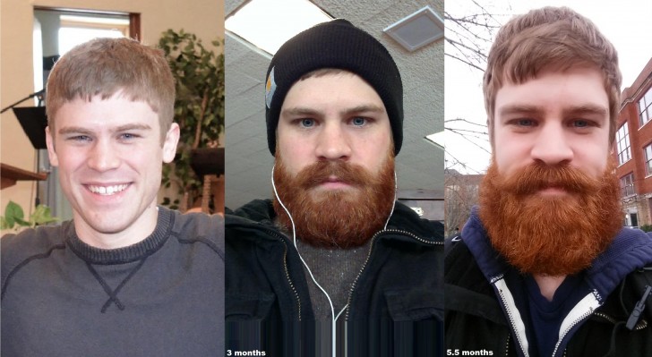 14. An explanatory photo of "how a beard grows in just 5 months"!