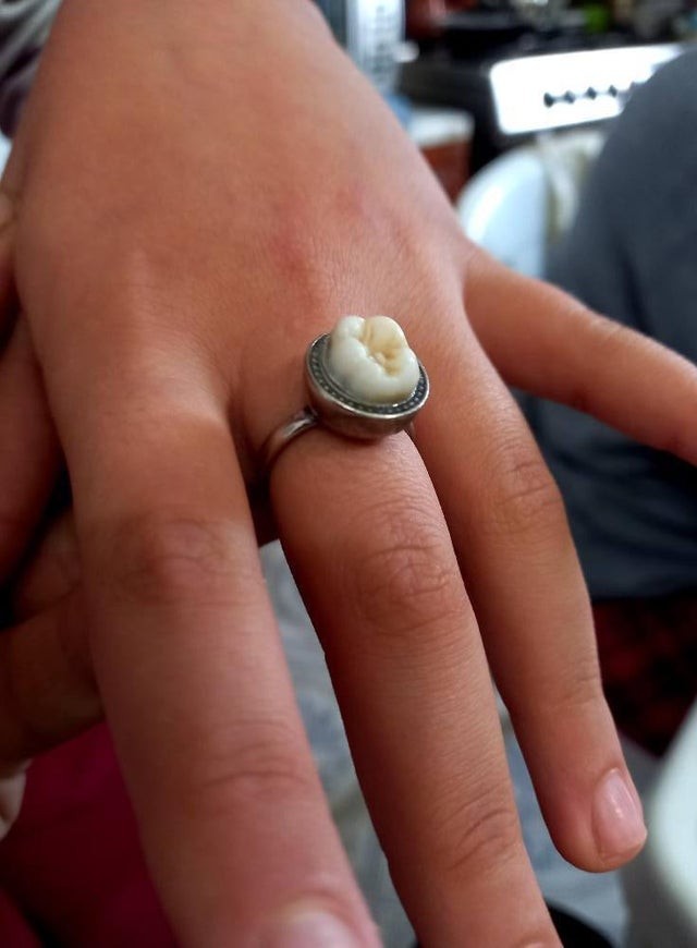 A ring ... with a tooth!