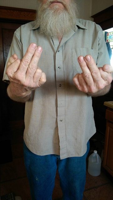 14. Mon père et ses mains avec... 6 doigts !