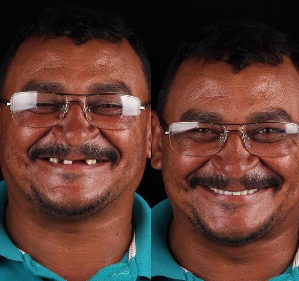 16. Aveva pochi denti, ma Felipe a quest'uomo ne ha donato degli altri. Il risultato è un bellissimo sorriso felice.