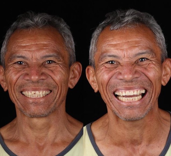 6. Un sourire pour prendre la photo à gauche et un vrai et authentique sourire à droite : voici le miracle que le dentiste a réussi à accomplir.