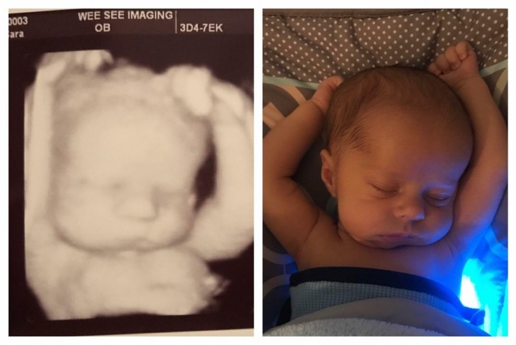 1. Une comparaison entre l'échographie du bébé et celle du bébé né il y a quelques semaines : la tendre posture est restée exactement la même.