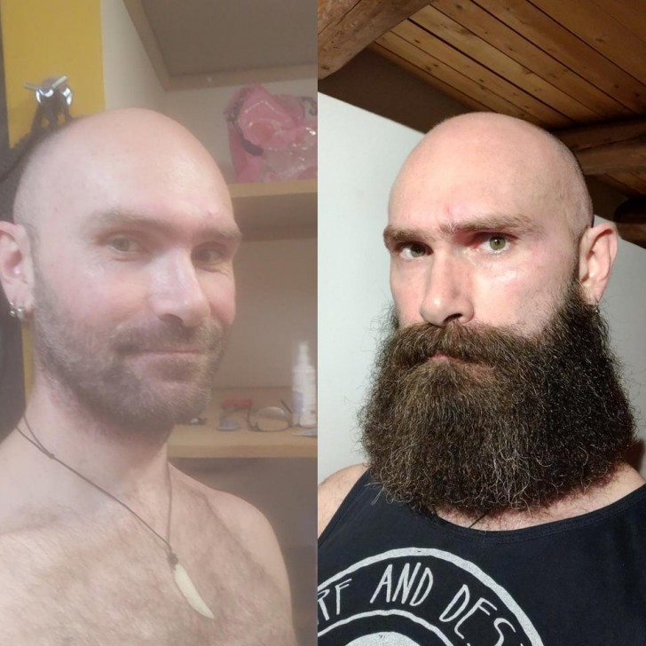 Sechs Monate harter Arbeit, um mir den Bart wachsen zu lassen und mein Aussehen zu verbessern: Ich denke, dass es mir vortrefflich gelungen ist!