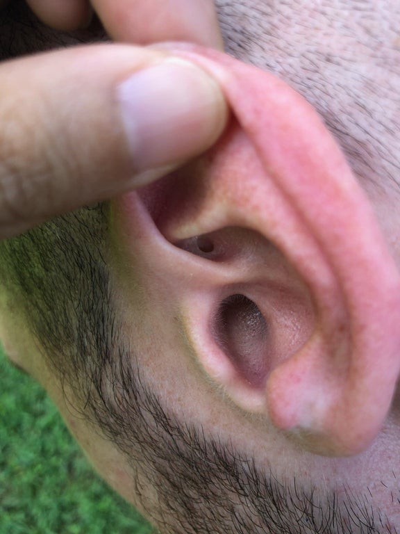 11. Il y a un petit trou dans l'oreille.