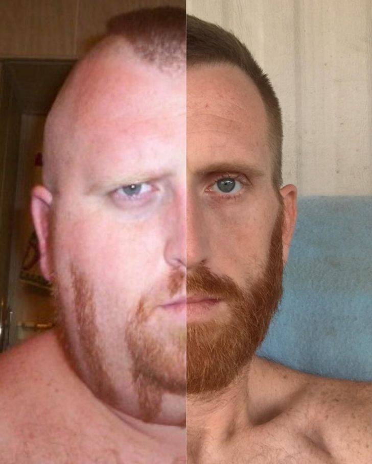 1. "Mitt ansikte före och efter att ha förlorat 158 ​​kg"