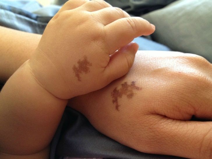 A mother and her newborn baby share the same mark on their hands...