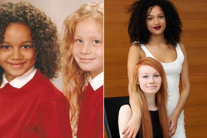 3. Twin sisters, born to a white father and a half Jamaican mother