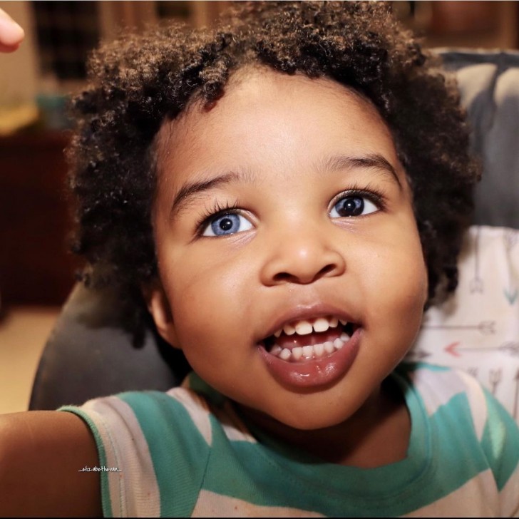 10. This little girl has one blue eye and one darker one: an incredible "trick" of genetics!