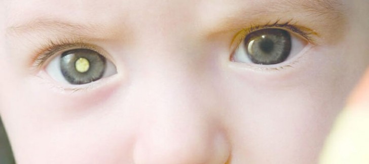 9. Riflessi bianchi delle pupille in foto