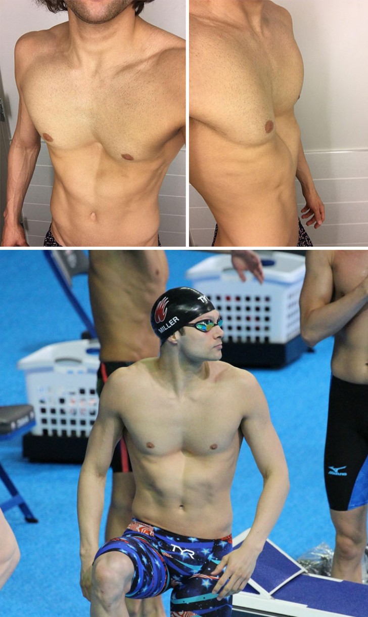 Zwemmer Cody Miller heeft een bijzondere fysieke afwijking waardoor je hem meteen herkent