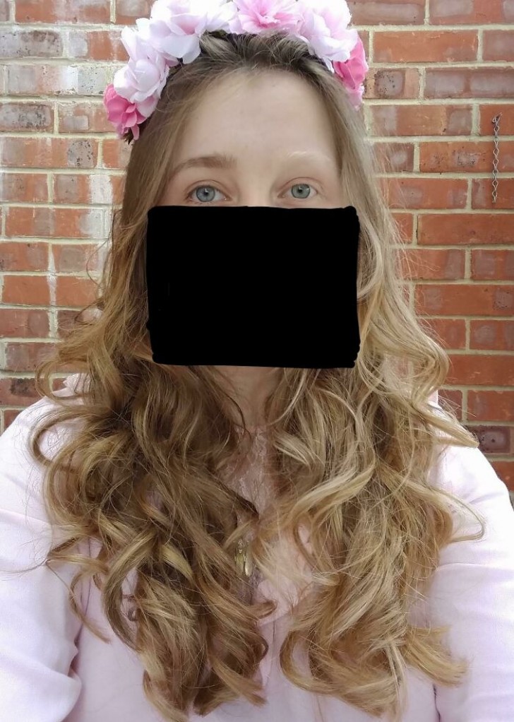 7. "Mein Haar ist halb blond und halb braun, genauso wie meine Wimpern und Augenbrauen.