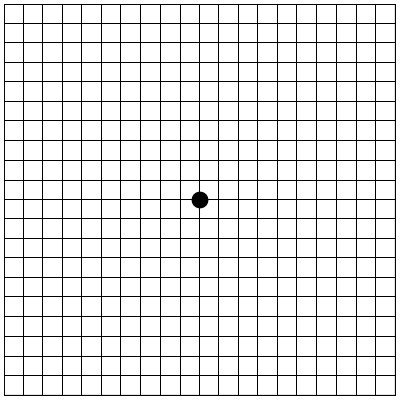 Copri un occhio e fissa il punto nero al centro: il test usato dai medici per scoprire questo problema agli occhi - 2