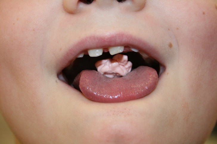 Ingerire spesso i chewing gum: ecco cosa può accadere