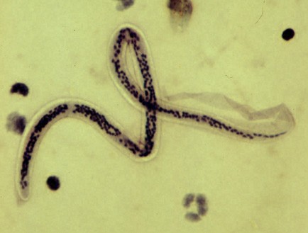 Nematodi, i minuscoli vermi dalle incredibili caratteristiche