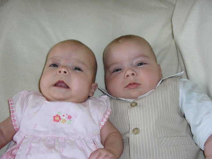 Malattie nei gemelli: fattori ambientali o genetici?
