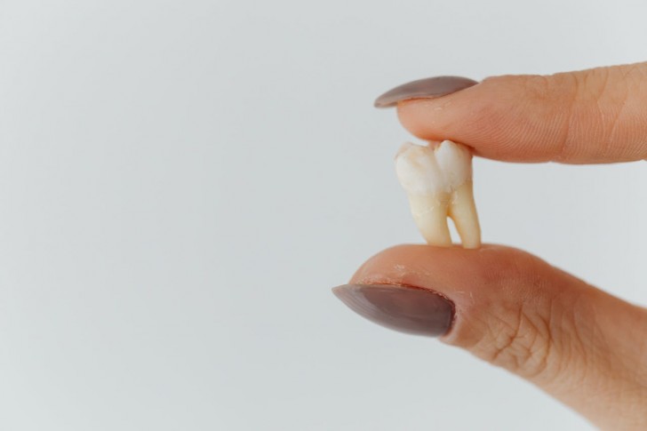 Quelle est l'histoire des dents de sagesse et pourquoi disparaissent-elles ?