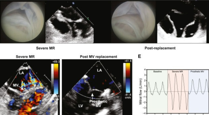 Cuore biorobotico, lunga conservazione e studio del rigurgito mitralico