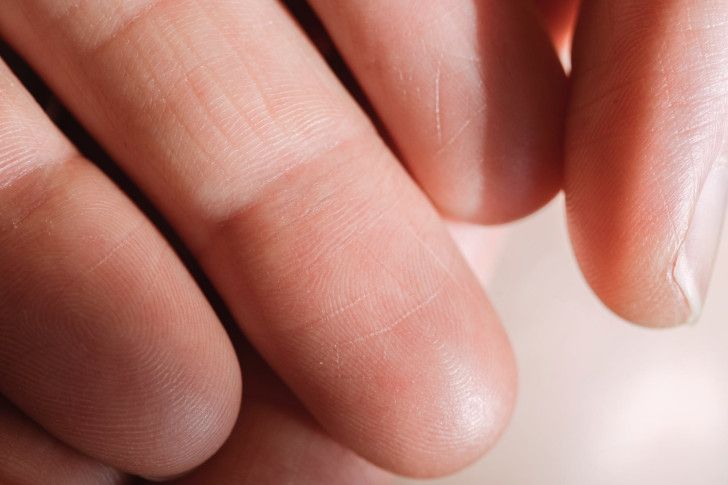 Fingerabdrücke sind nicht immer einzigartig: Eine revolutionäre Entdeckung