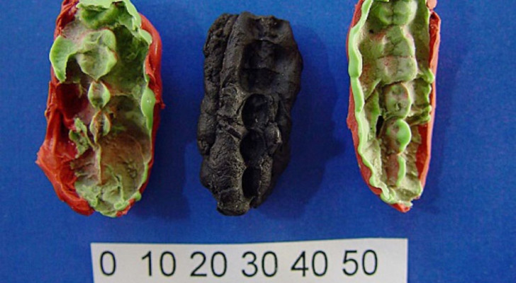 Detta är vad forskarna hittade i det förhistoriska tuggummit