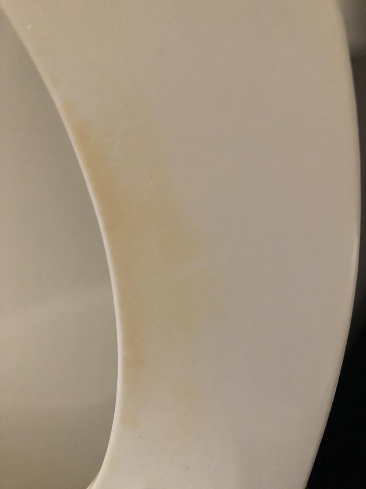 Detail van een wc-bril ontsierd door geelachtige vlekken