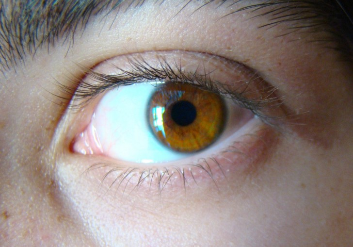 Prima di allora, tutte le persone avevano gli occhi marroni. Poi un gene conosciuto come OCA2 iniziò a creare quei cambiamenti che portarono alla mutazione del pigmento