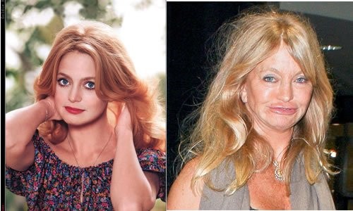 10. Goldie Hawn, 70 jaar