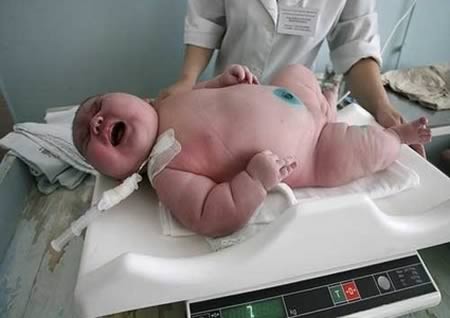 Ademilton dos Santos, il neonato più grande del Brasile