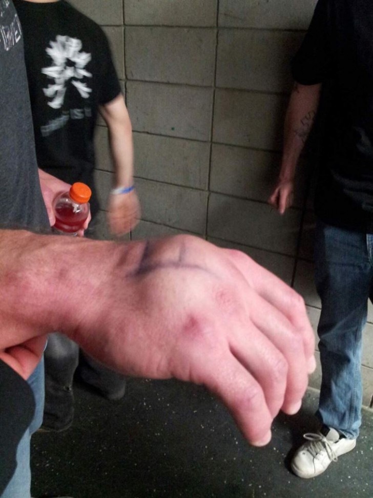 Die Hand eines Boxers nach einem K.O.