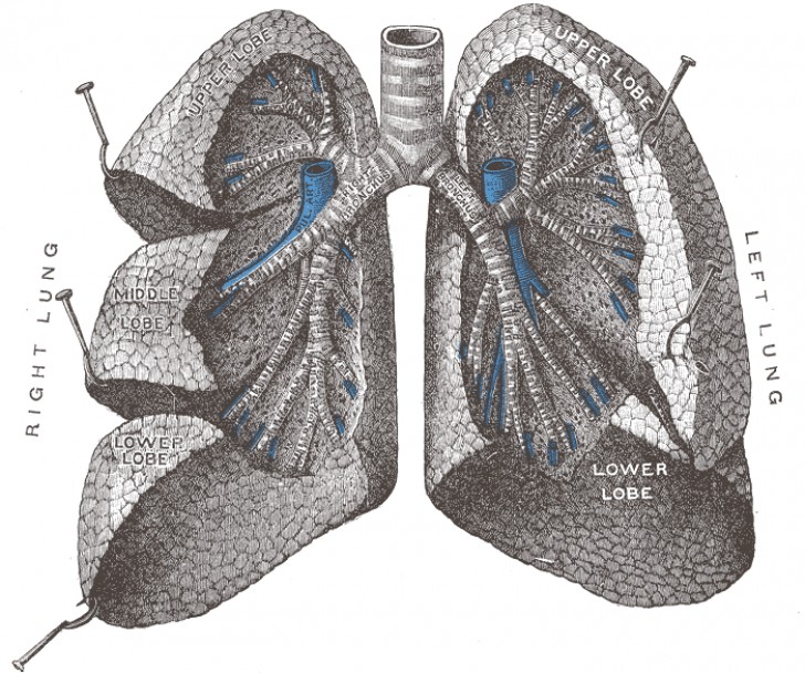 Il cancro ai polmoni è una delle malattie con i più alti tassi di mortalità in tutto il mondo.