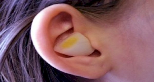 Cuore di cipolla contro otite e mal d'orecchio