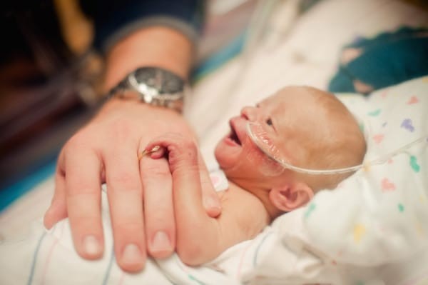 A leur arrivée à l'hôpital, cependant, il y a une autre nouvelle, malheureusement dramatique, qui les attendent, l'un des deux bébé est né sans cerveau