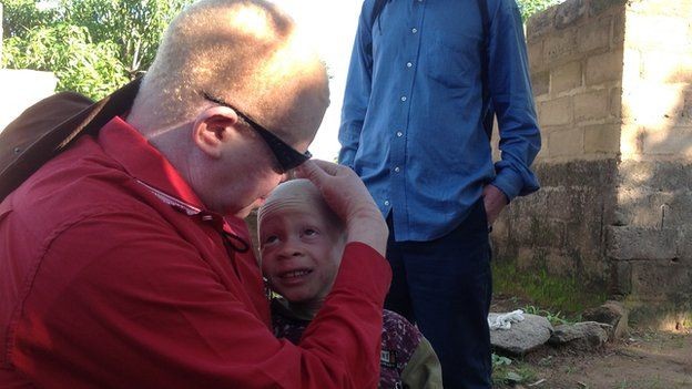 I giovani albini provenienti da tutta l'Africa sono ospitati in un alloggio speciale e protetti dall'esercito.