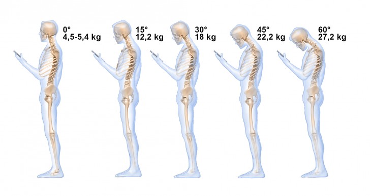 La dipendenza da cellulare è deleteria per il collo: come si vede nel disegno, il peso imposto al collo dipende dall'inclinazione assunta dalla testa