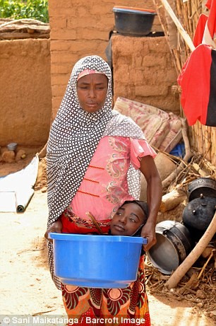 Comme tous ses pairs, c'est une jeune femme souriante, mais depuis qu'elle est née, elle combat une maladie qui la rend différente. Son corps ne grandit plus depuis l'âge de 6 mois.