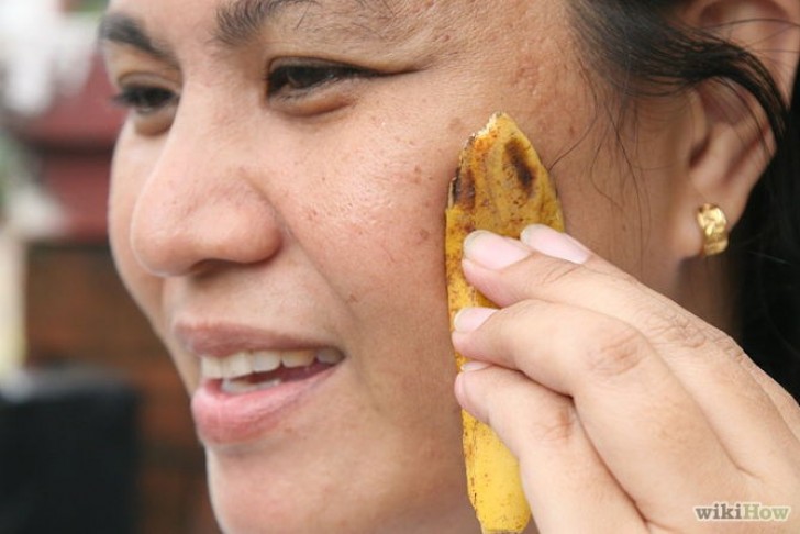 17. Acne Problems? Gently rub the inside of the banana peel on the affected area and leave it there for a few minutes, then rinse.