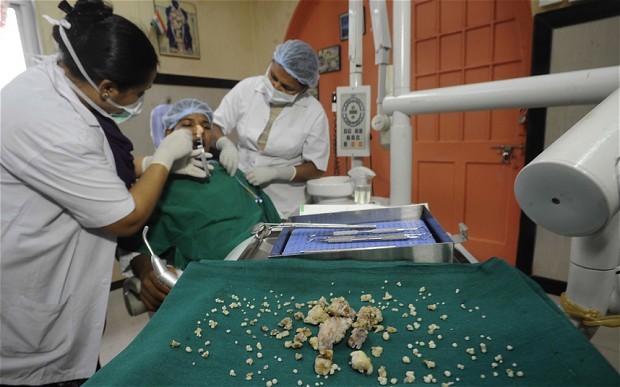 Il y a un mois, Ashik s'était adressé vers une clinique du quartier de Byculla à cause de ses fortes douleurs dans la mâchoire. Après avoir trouvé la croissance anormale d'une molaire, les médecins ont décidé d'opérer le garçon ...