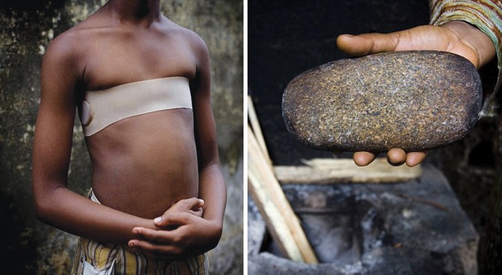 Stiramento del seno delle bambine: un barbarico rituale... dalla spiegazione surreale