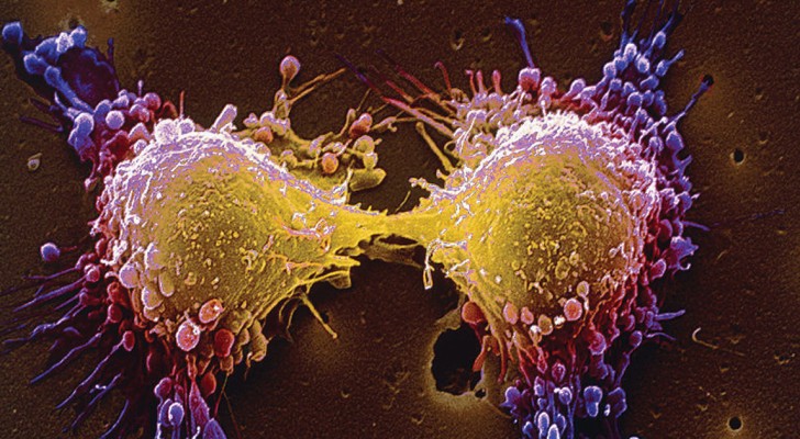 Individuata la proteina responsabile delle metastasi tumorali: ora un farmaco mirato potrebbe bloccarla