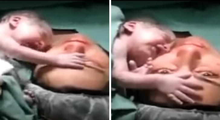 Das Neugeborene wird an das Gesicht der Mutter gehalten: seine Reaktion rührt auch die Ärzte.