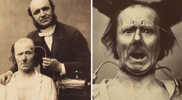 La genèse des expressions du visage humain: l'intéressante étude d'un neurologue français de 1862
