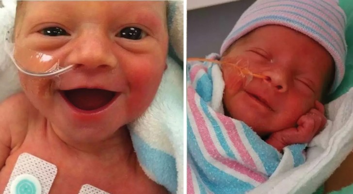 Les toutes premières images de bébés nés prématurés: leurs sourires sont un hymne à la vie