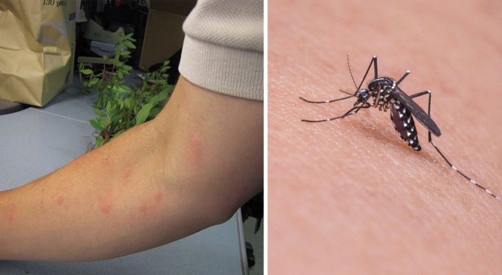 Einige Gründe, warum Mücken manche Menschen lieber stechen als andere
