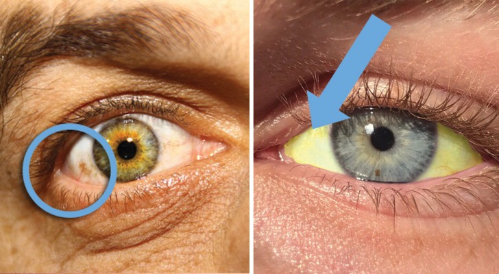 12 condizioni del nostro corpo che possiamo diagnosticare dagli occhi