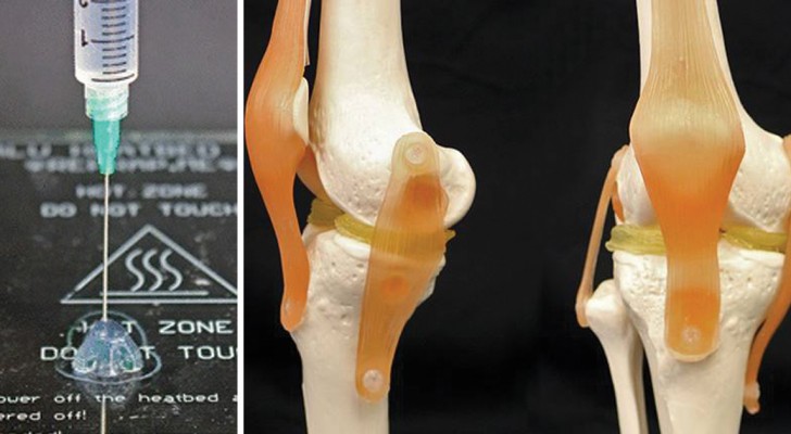 Knorpel in 3D Druck, die zum menschlichen Körper passen: Ein neues Material machts möglich