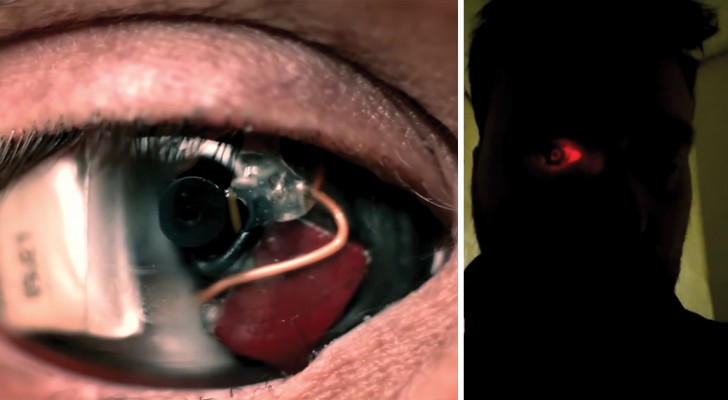 Eyeborg: quest'uomo si è fatto impiantare una protesi-telecamera nell'occhio destro