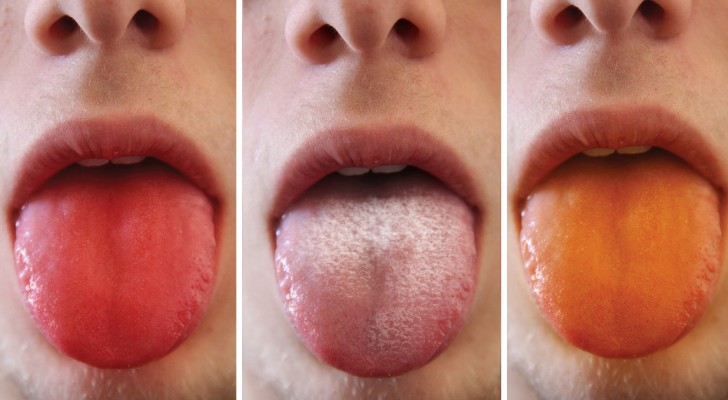9 Aspekte der Zunge, die uns etwas über unseren Körper verraten